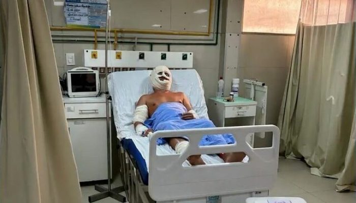 A Polícia investiga se houve negligências do tutor de dois cães da raça pitbull que deixou três pessoas feridas no bairro Pindoba em Paço do Lumiar
