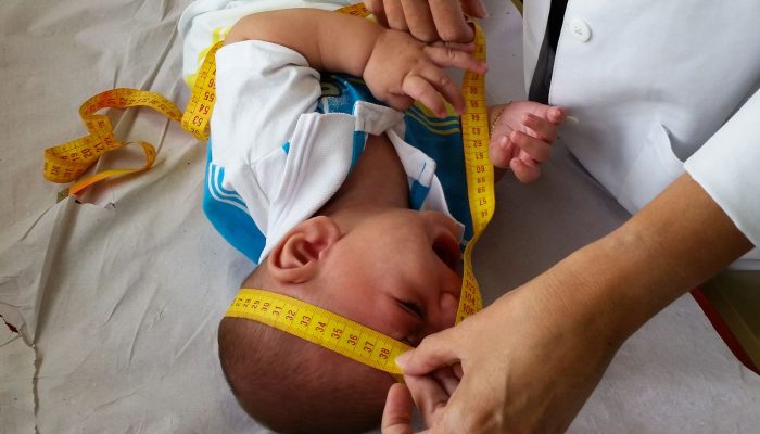 INSS pagará indenização de R$ 60 mil a crianças vítimas de zika