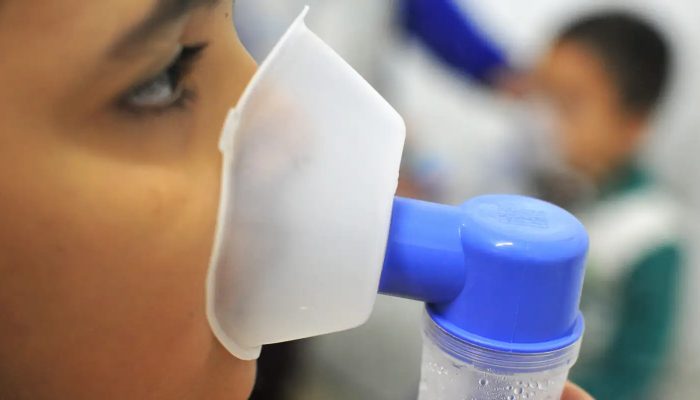 Fiocruz: 72,5% dos óbitos por SRAG estão relacionados à influenza A
