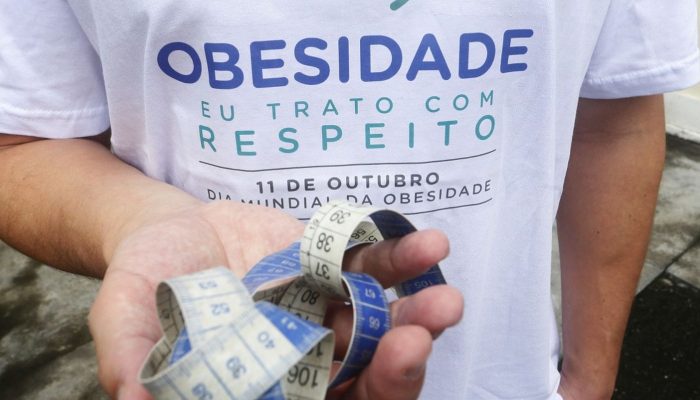 Jovem a partir dos 14 anos passa a poder fazer cirurgia bariátrica